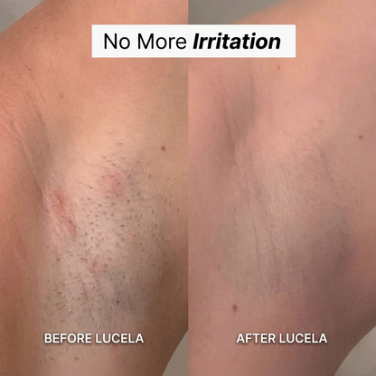 5-in-1 Razor Lucela