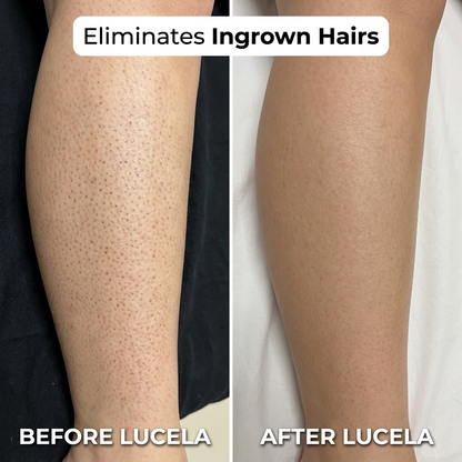 5-in-1 Razor Lucela